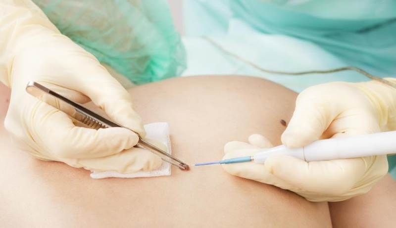 δερματοχειρουργικη