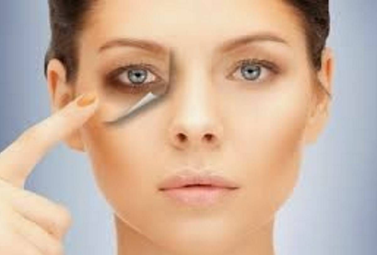 Μαυροι κυκλοι θεραπεια