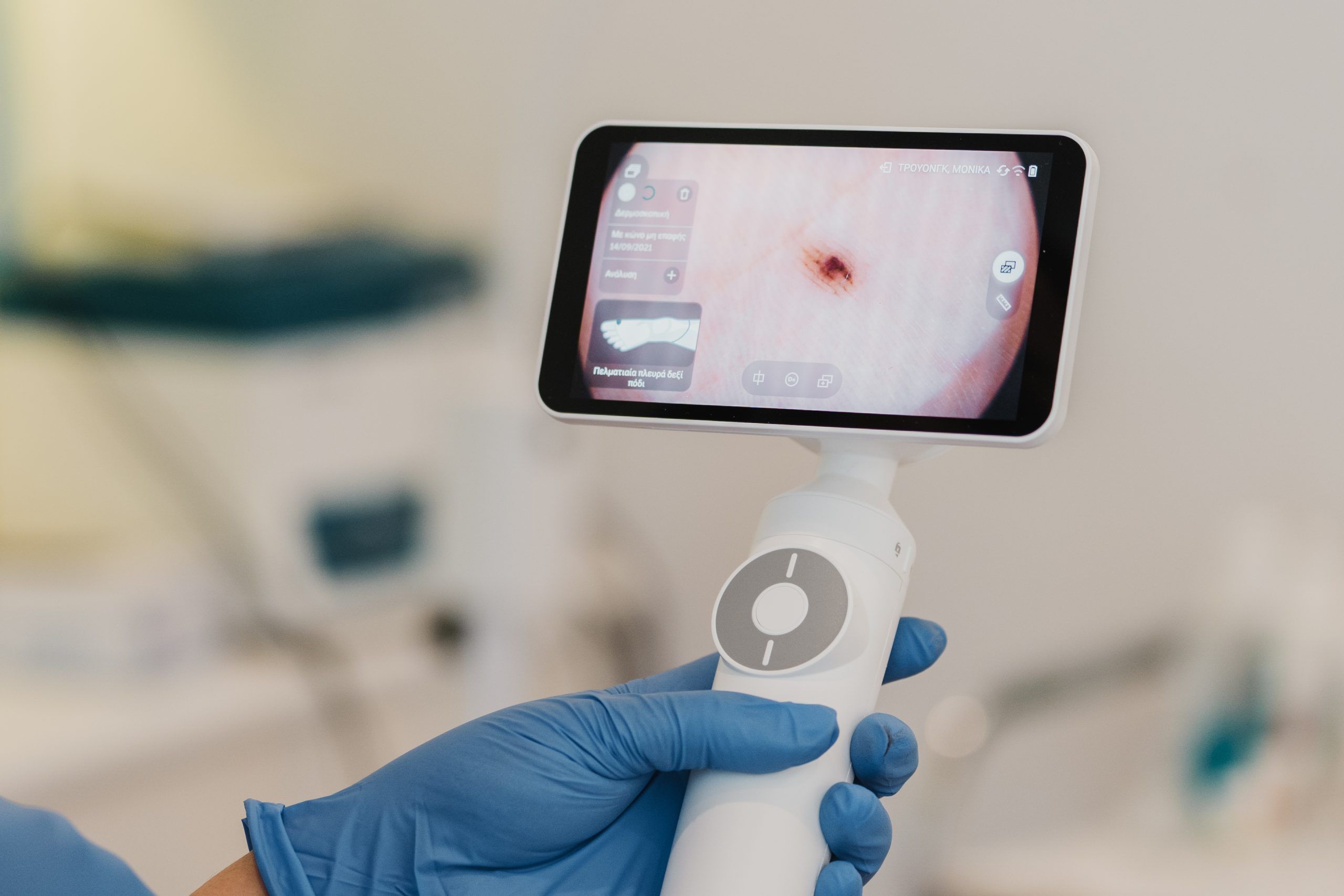 χαρτογραφηση σπιλων