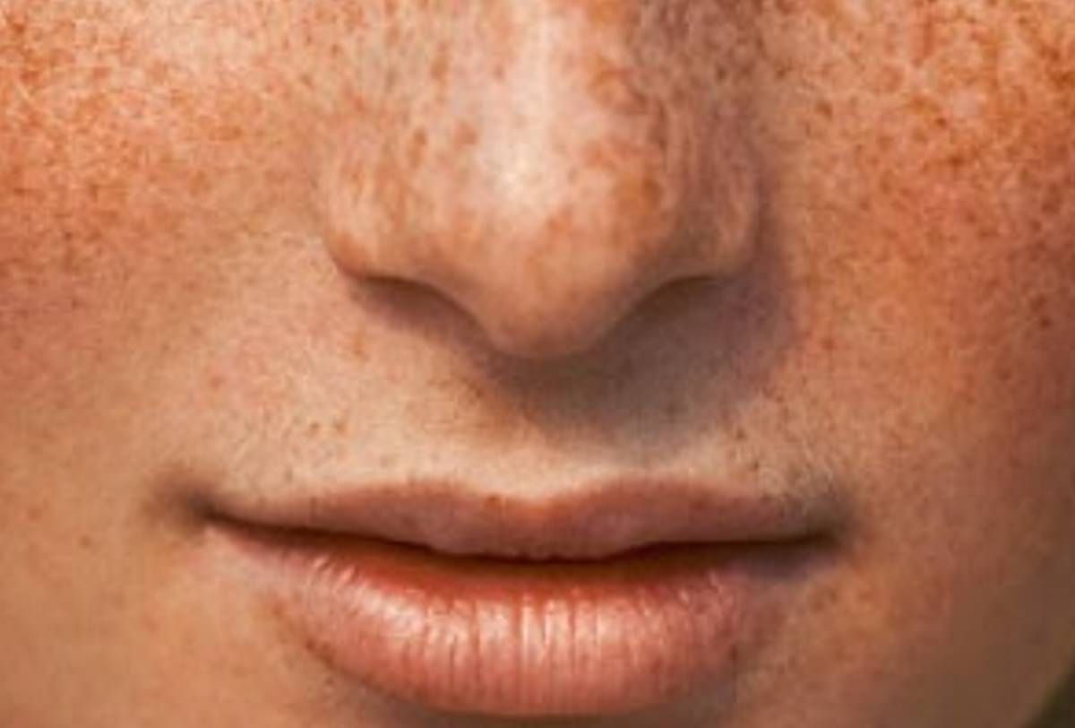 παναδες αντιμετωπιση