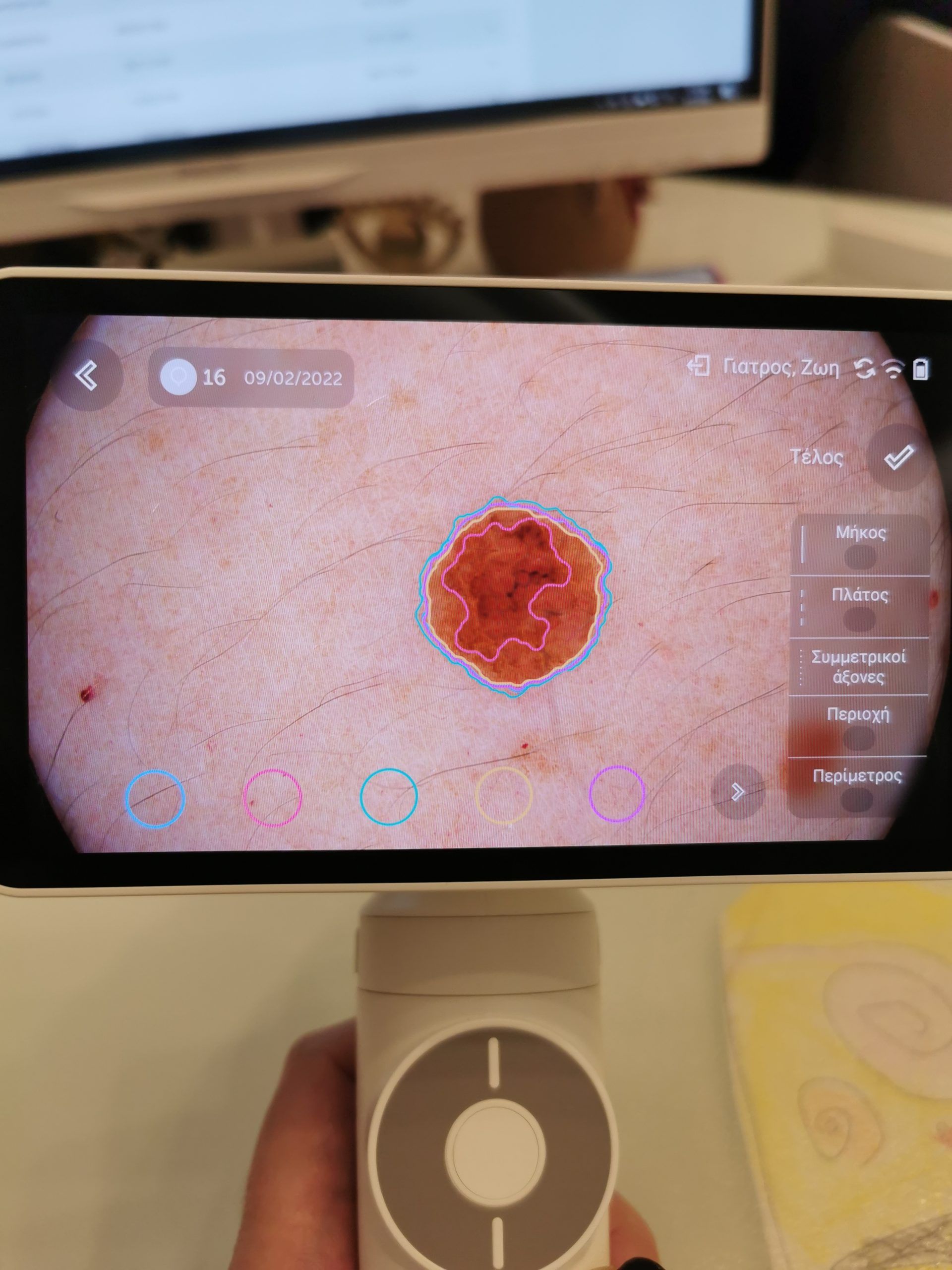 αφαιρεση σπιλων